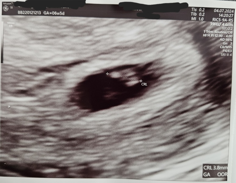 Early scan dating 2 weeks behind