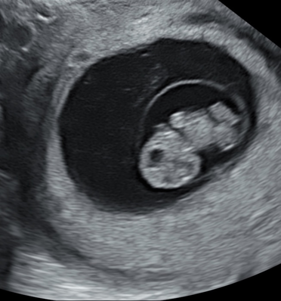 Due February 2025 - Thread 2