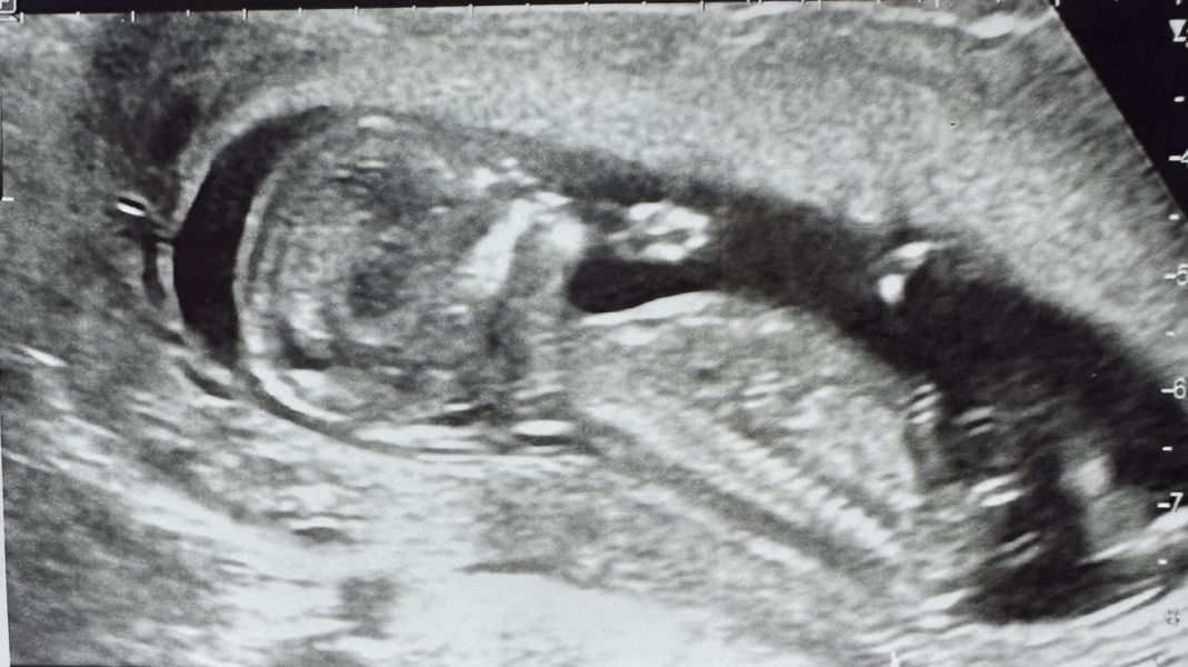 BFP after IVF - anyone want to join me in the wait for first scan?
