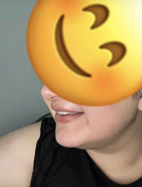 Honest thoughts on my smile