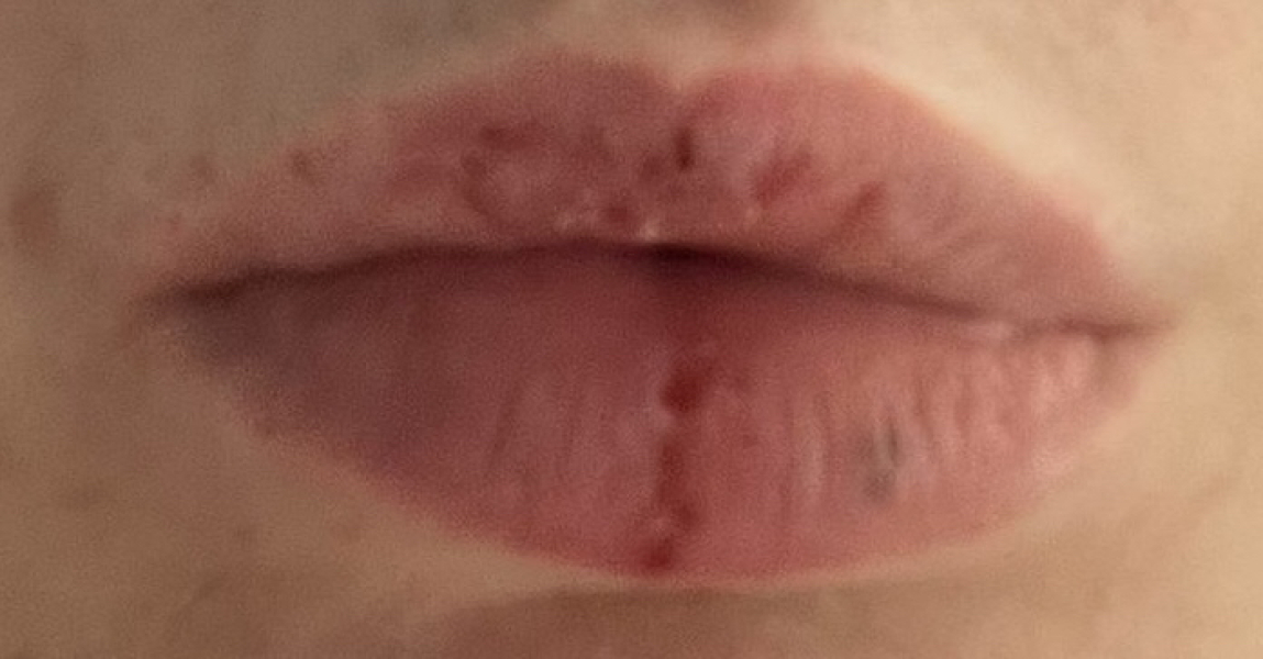 BFP after recent loss (Thread 2) 🌈