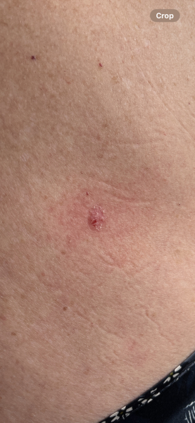 Funny looking mole type thing