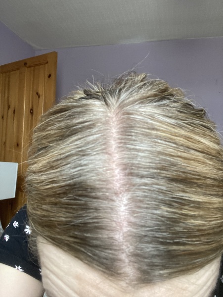 Hair crisis