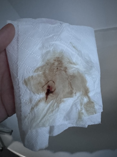TMI photo bleeding