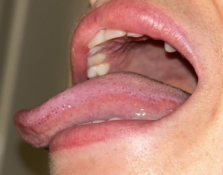 Do I have Scarlett fever !? Photos attached