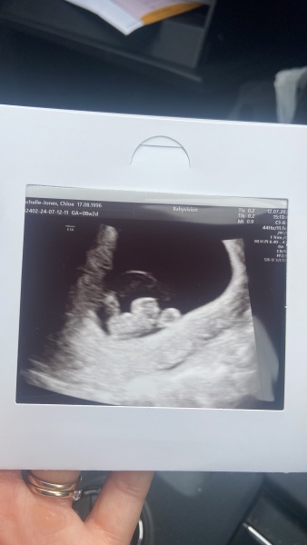 BFP after recent loss