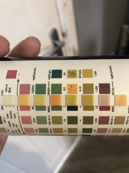 Dip stick urine test