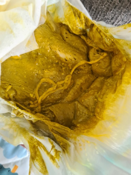 TMI baby poop 14 week old (image included prewarning)