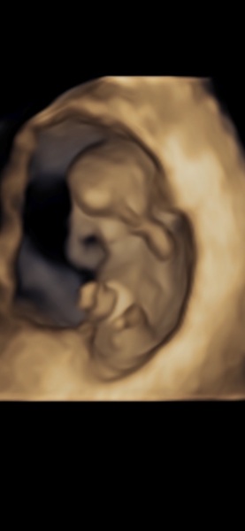 4d scan at nearly 11 weeks