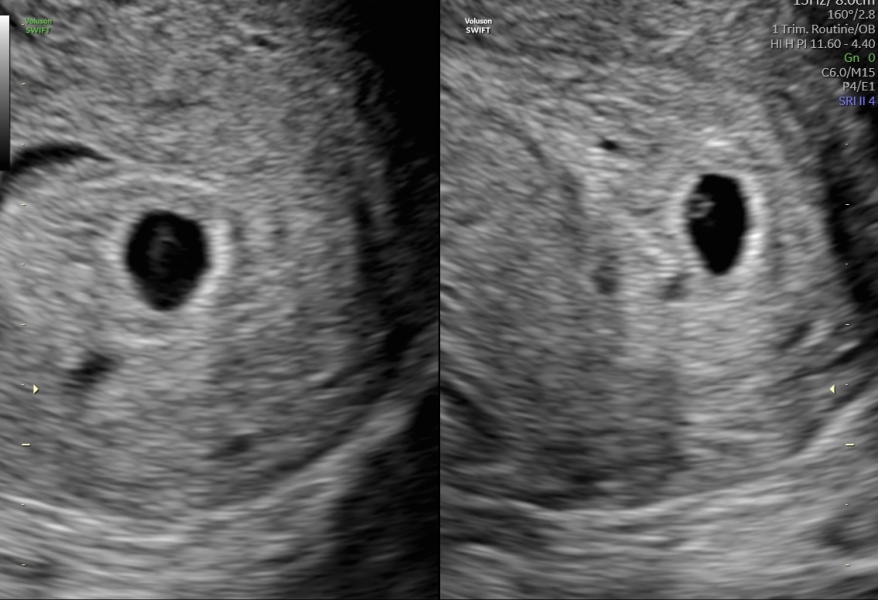 Scan reassurance