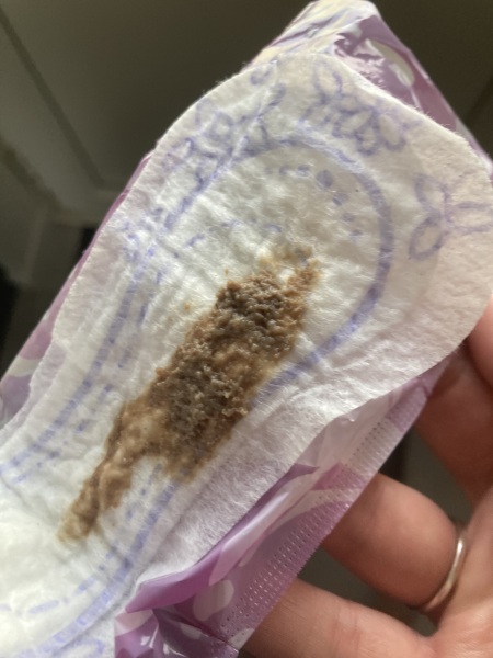 Is this my mucus plug
