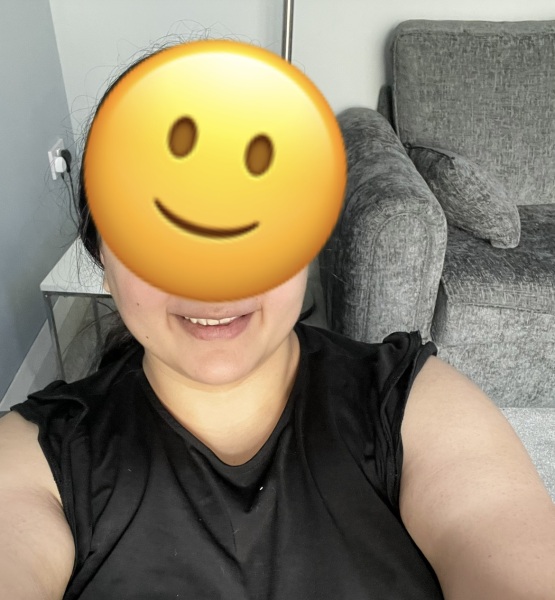 Honest thoughts on my smile