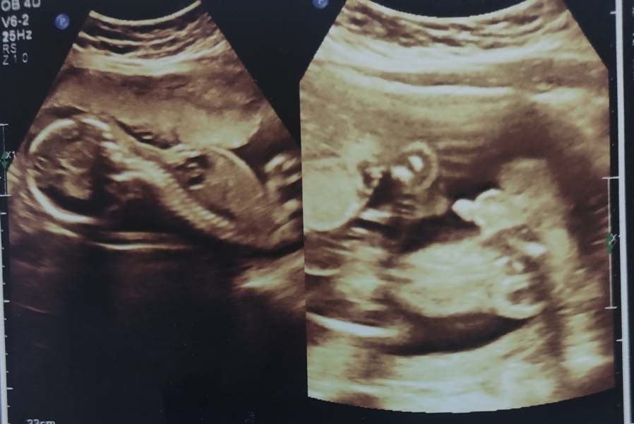 Guess my baby gender?