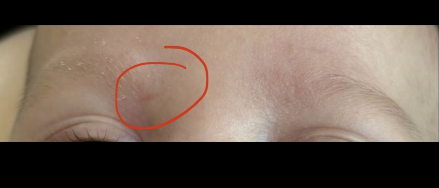 Baby scratched face how long does it take to heal?