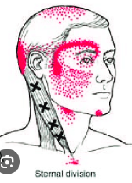 Sinus pressure but no other symptoms - anyone else get this?