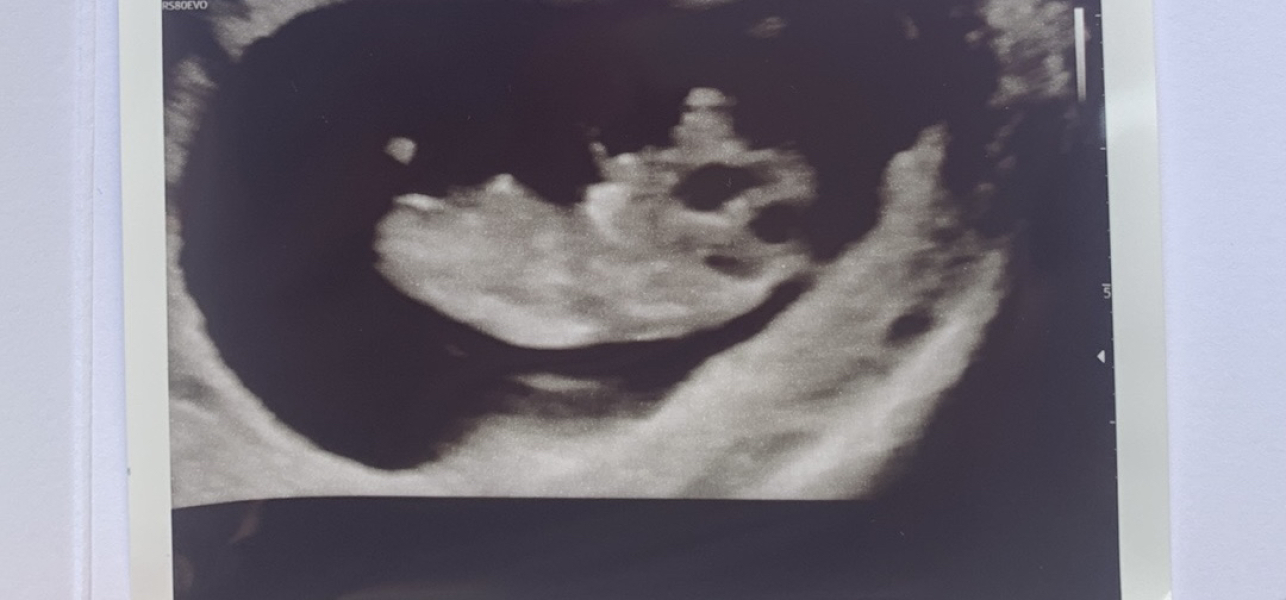 Due February 2025 - Thread 2