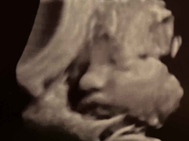 OCTOBER 2024 BABIES - Thread 4