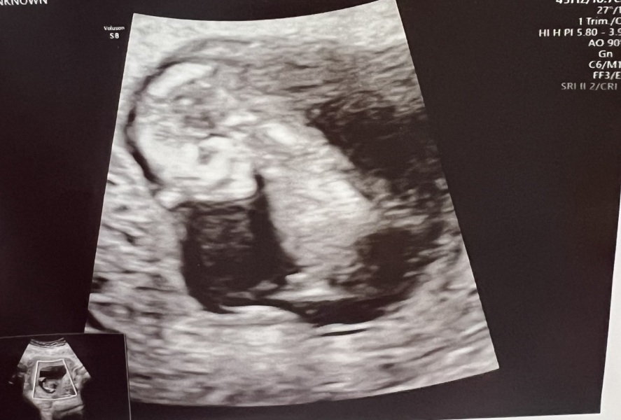 First time mum. Nub theory
