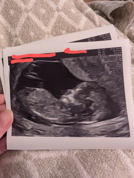 Boy or Girl ?