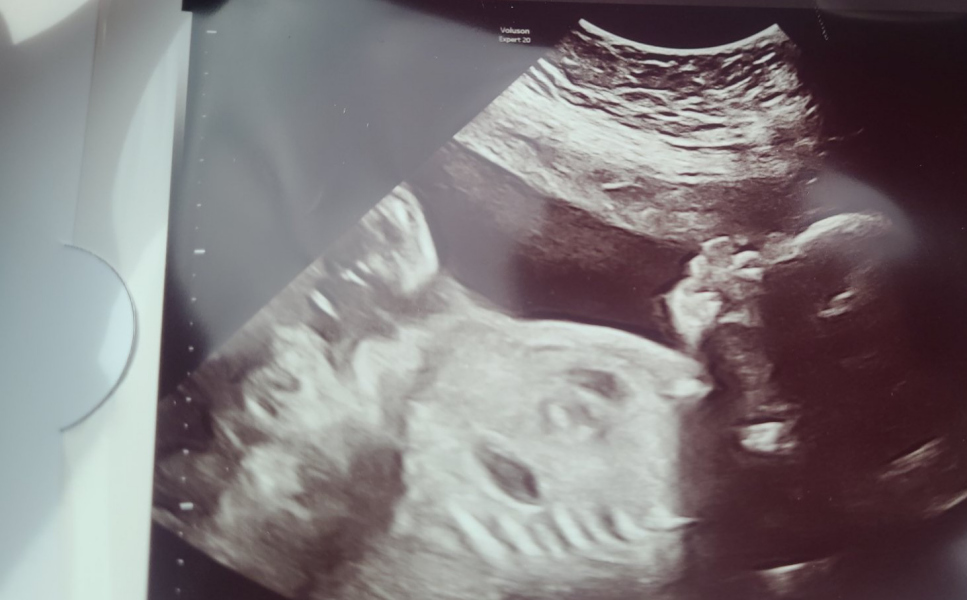 Boy or girl?...
