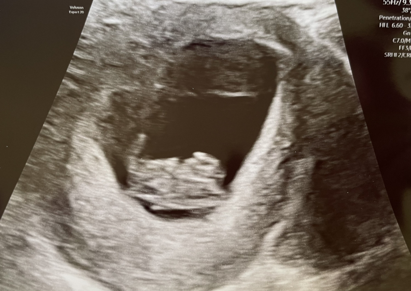 Anyone TTC Dec 2023…continued