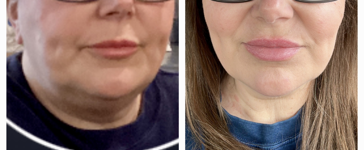 Just wanted to share my almost 3 month progress on MJ - pic