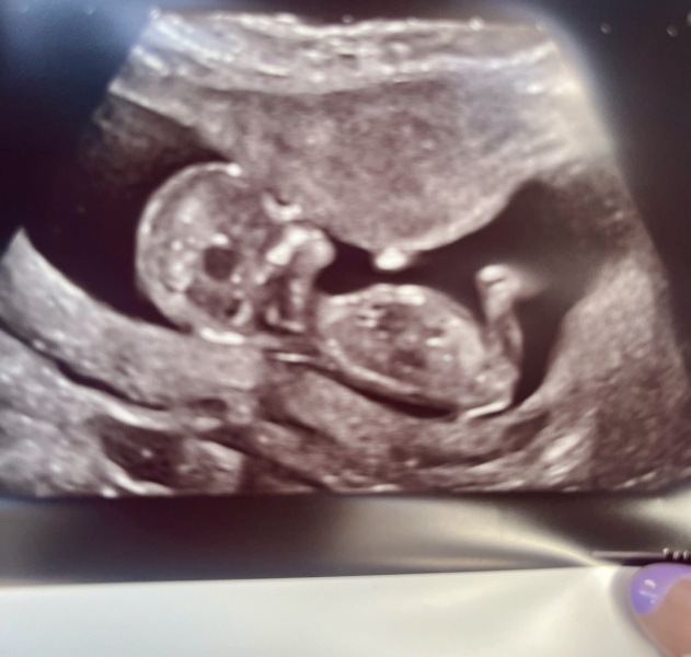 BFP after IVF - anyone want to join me in the wait for first scan?