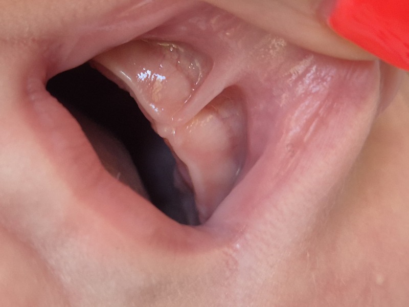 Teething?
