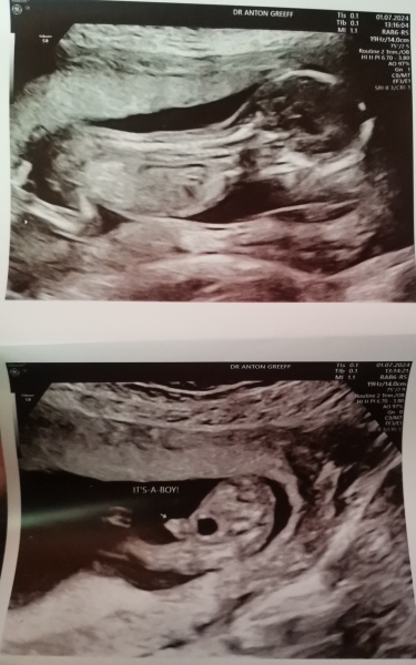 Gender guess