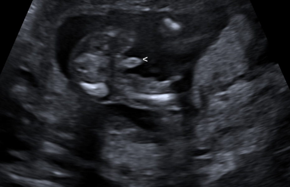 Is this really a boy? Gender suspicion.