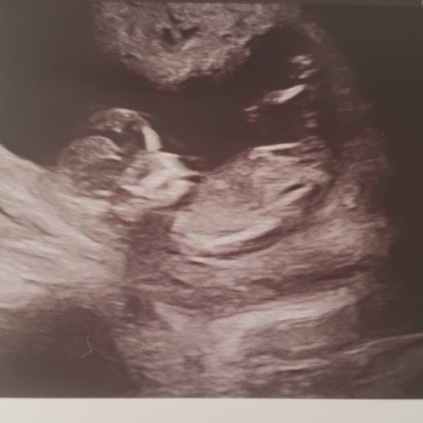 Girl or boy?
