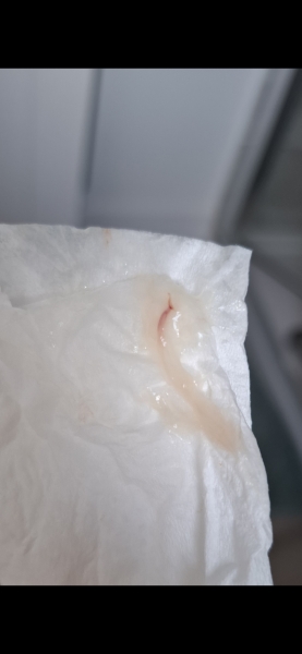 Blood streaked mucus plug?