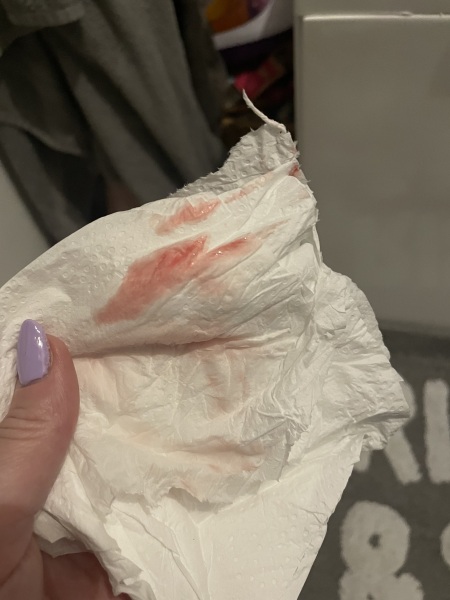 TMI pics ** bleeding after a positive test