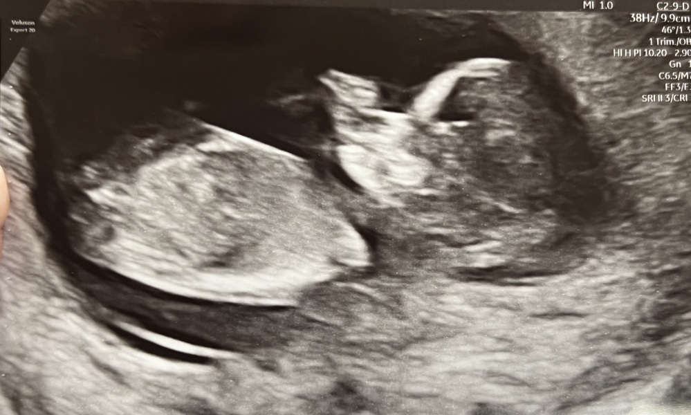 BFP after IVF - anyone want to join me in the wait for first scan?