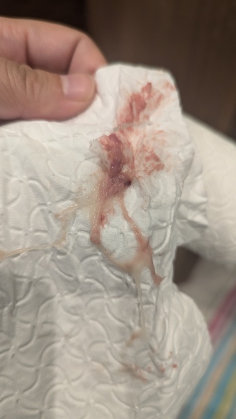 BFP after recent loss