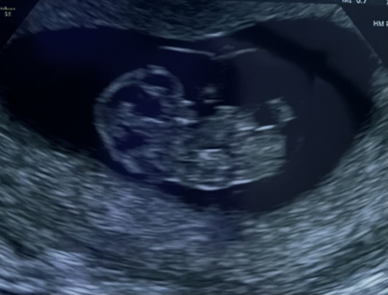 Due February 2025 - Thread 2