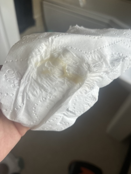 TMI - is this my mucus plug?