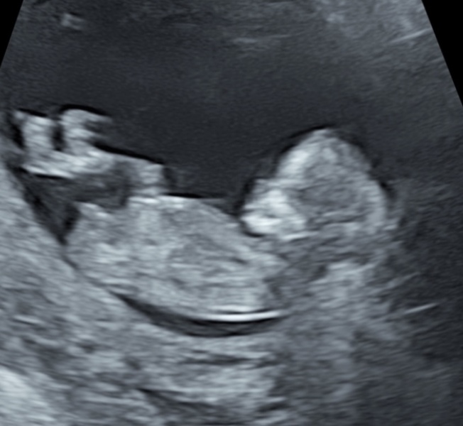 Guess of gender/sex please!