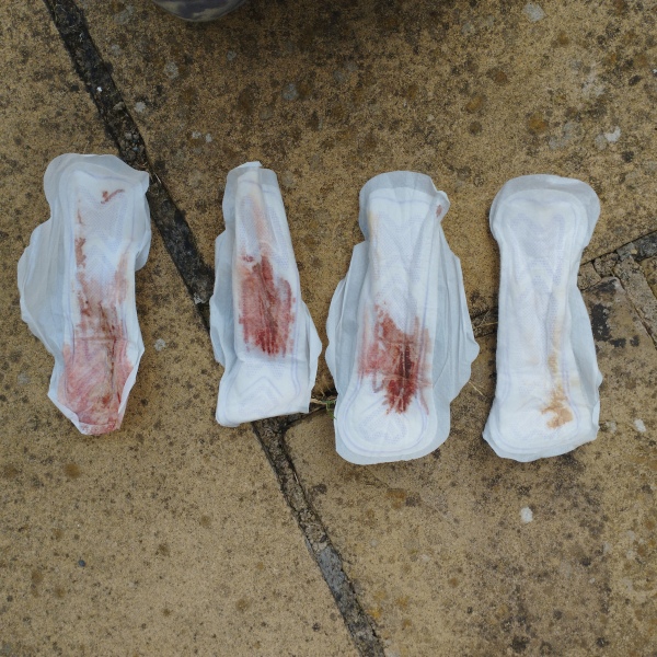 Could this be implantation bleeding? TW - sensitive content