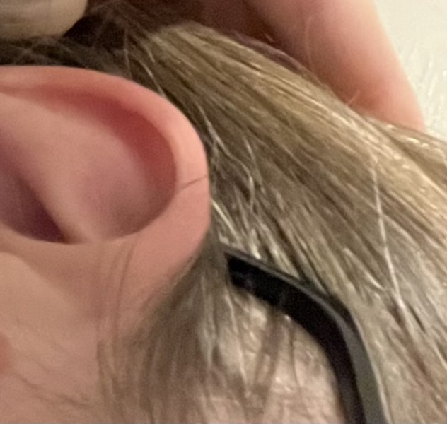 Where do your glasses sit  (picture attached)