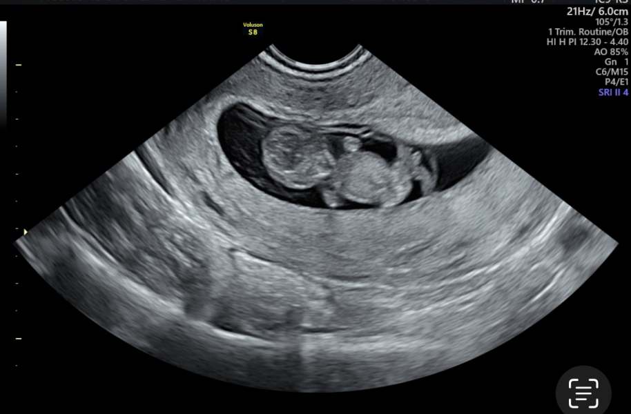 Due February 2025