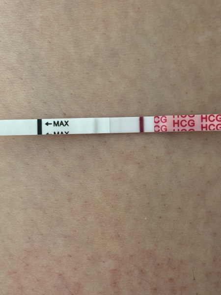 Line eyes- am I going mad?!!!