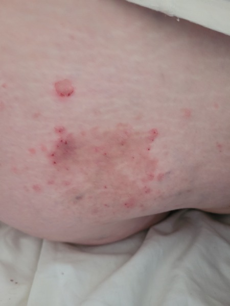 Ideas on this skin condition?