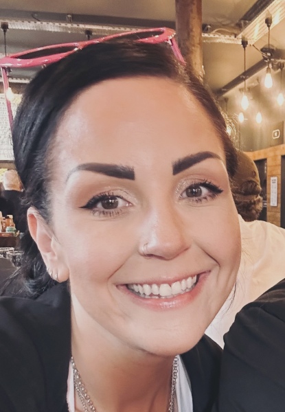 Gummy Smile Botox problem - pic included.