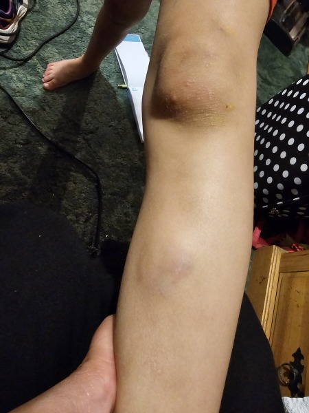 Is this normal?
