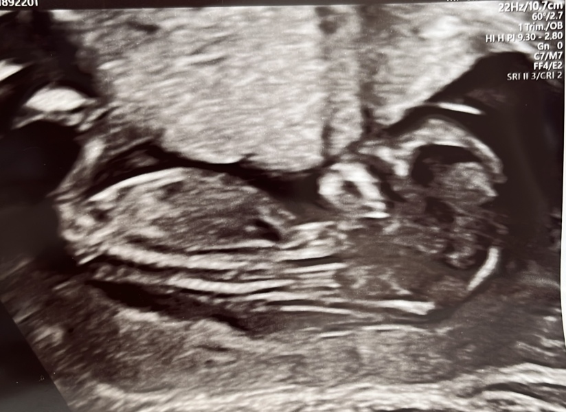 Due February 2025 - Thread 2