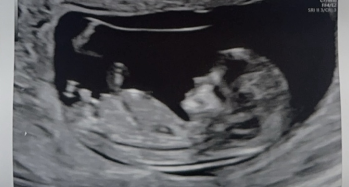 12 weeks nub theory game! (Repost)