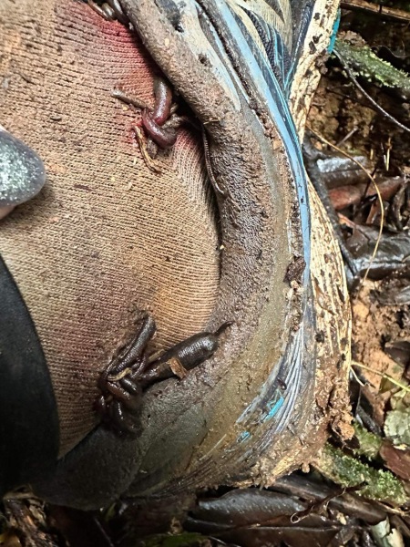 Attacked by Leeches- TMI Photos