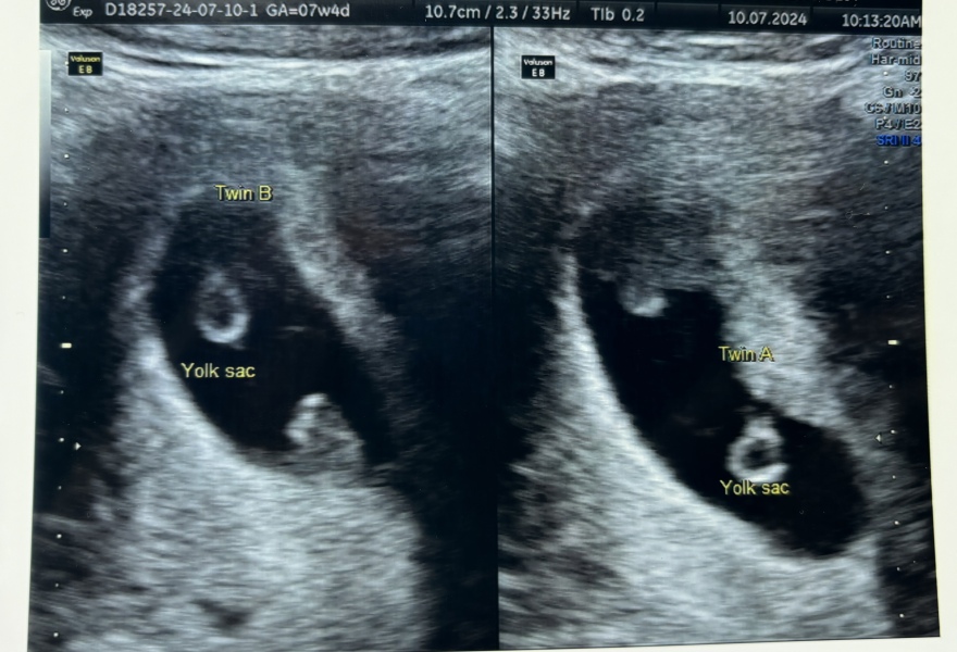 Due February 2025 - Thread 2