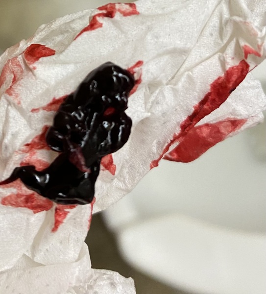 TW!! Am I miscarrying